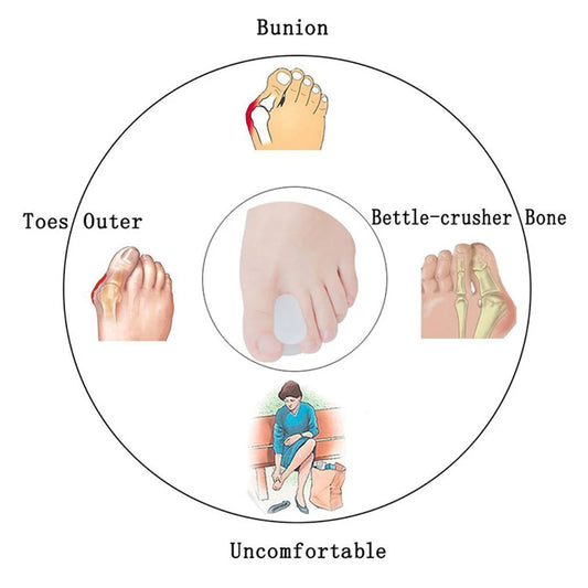 1 Pair Silicone Bone Thumb Orthotics Corrector Hallux Valgus Toe Separator Feet Care Thumb Orthotics Foot Care Tools 2020 S/L.