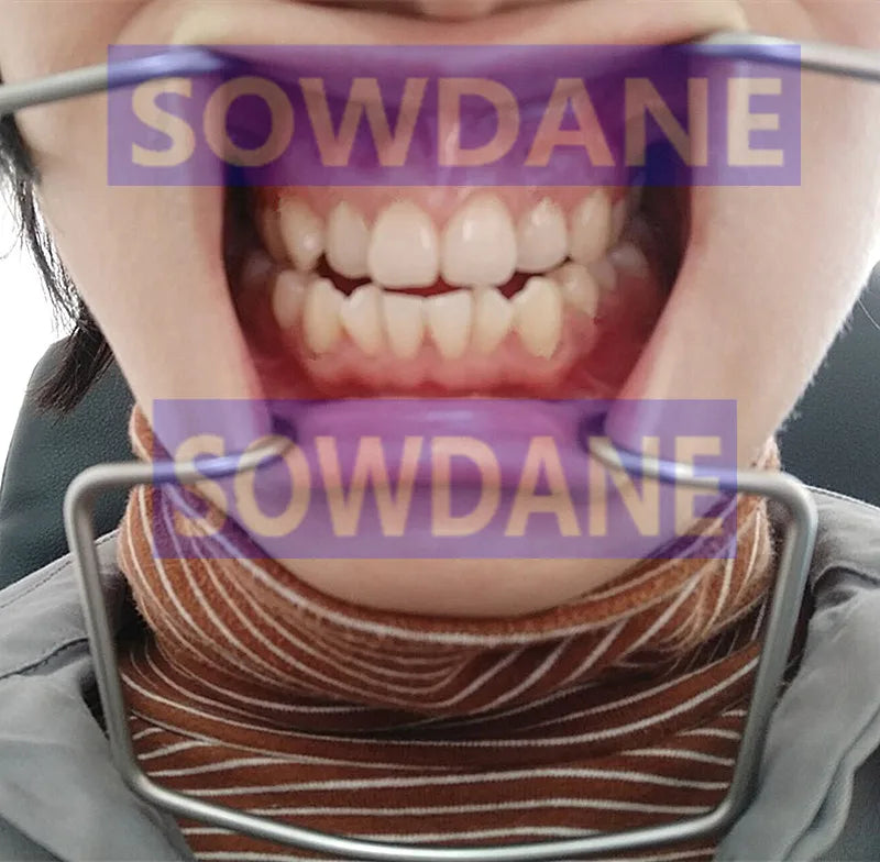 1 piece Dental Implant Lip & Cheek Retractor Orthodontic Surgical Mouth Opener Instrument Autoclavable Stainless Steel.