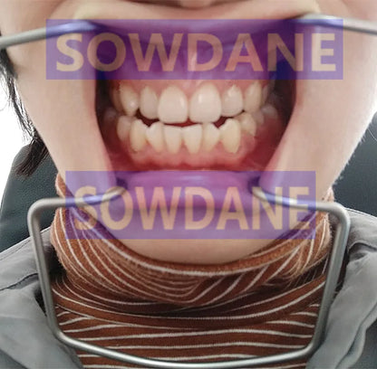 1 piece Dental Implant Lip & Cheek Retractor Orthodontic Surgical Mouth Opener Instrument Autoclavable Stainless Steel.