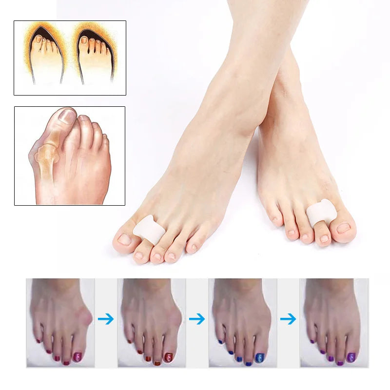 2pcs=1pair Silicone Toe Corrector Gel Protector Finger Separator Orthopedic Products Hallux Valgus Pedicure Foot Care Hammer.