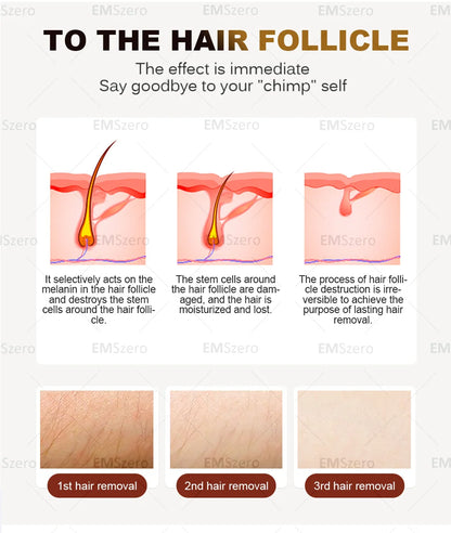 3000W Diode Laser Freezing Point Painless Hair Removal Picosecond Laser 532/1220/1064/755 Tattoo Removal Two In One Machine.