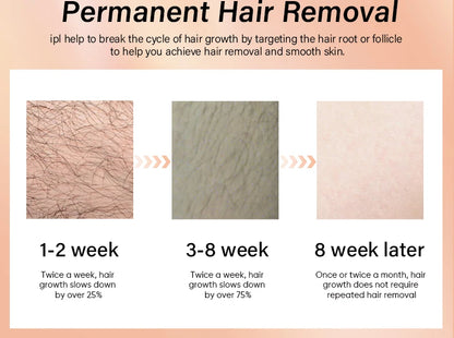 KODO 2025 High-end customization ice Laser Hair removal Laser Epilator Permanent IPL Painless Photoepilator 4 in 1 face and body.