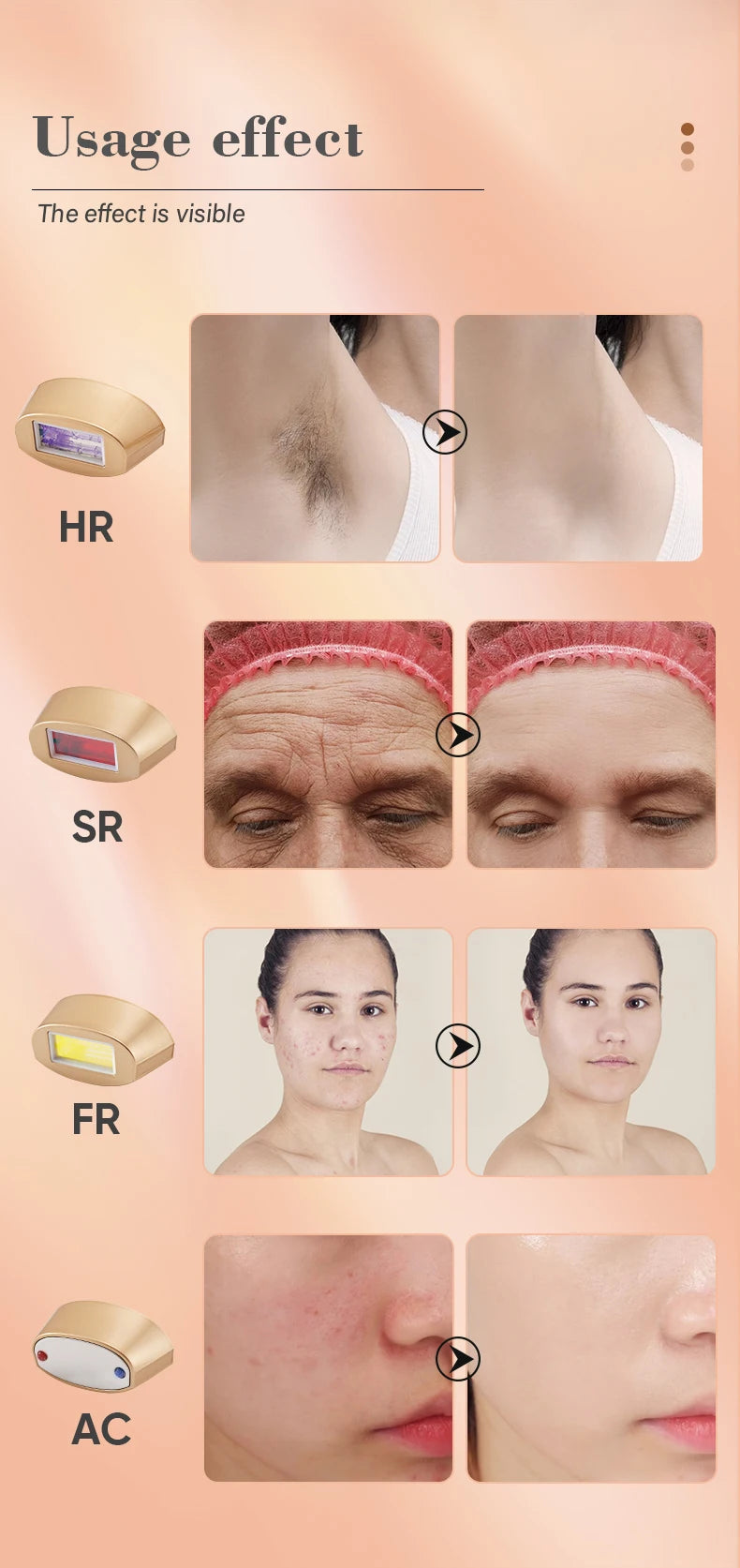 KODO 2025 High-end customization ice Laser Hair removal Laser Epilator Permanent IPL Painless Photoepilator 4 in 1 face and body.