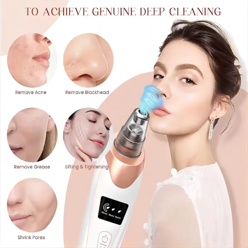 Newest Technology Blackhead Remover Vacuum Pore Cleaner for Face&Nose Blackhead Removal Kit Electric Acne Facial Extractor Tool.
