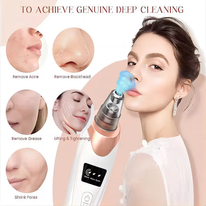 Newest Technology Blackhead Remover Vacuum Pore Cleaner for Face&Nose Blackhead Removal Kit Electric Acne Facial Extractor Tool.