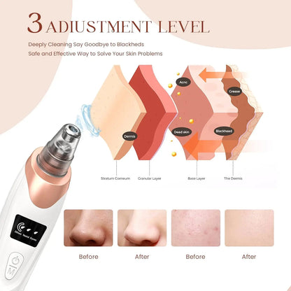 Newest Technology Blackhead Remover Vacuum Pore Cleaner for Face&Nose Blackhead Removal Kit Electric Acne Facial Extractor Tool.