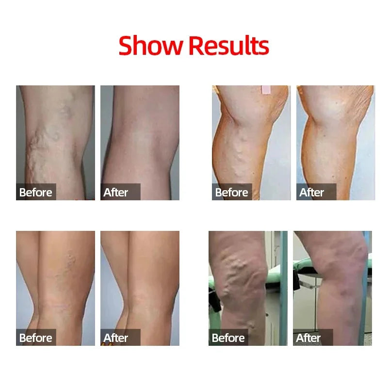 1 Pair Compression Calf Sleeves Running Leg Compression Sleeve Compression Socks for Shin Splint For Men Women 20-30mmHg.