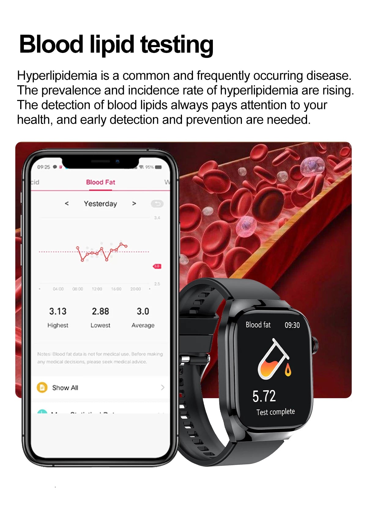 2025 New AI Intelligent Diagnosis ECG+PPG Smartwatch Health Protection Blood Lipids Uric Acid Heart Rate BT Call Smart Watch Men.