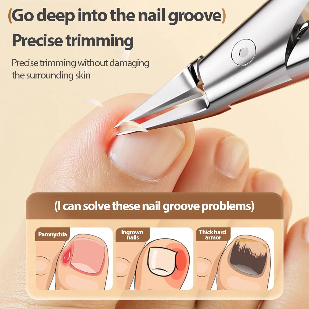 Stainless Steel Thick Nail Clippers Toenail Cutters Pedicure Manicure Tools Non-Splash Ingrown Paronychia Correction Tool.