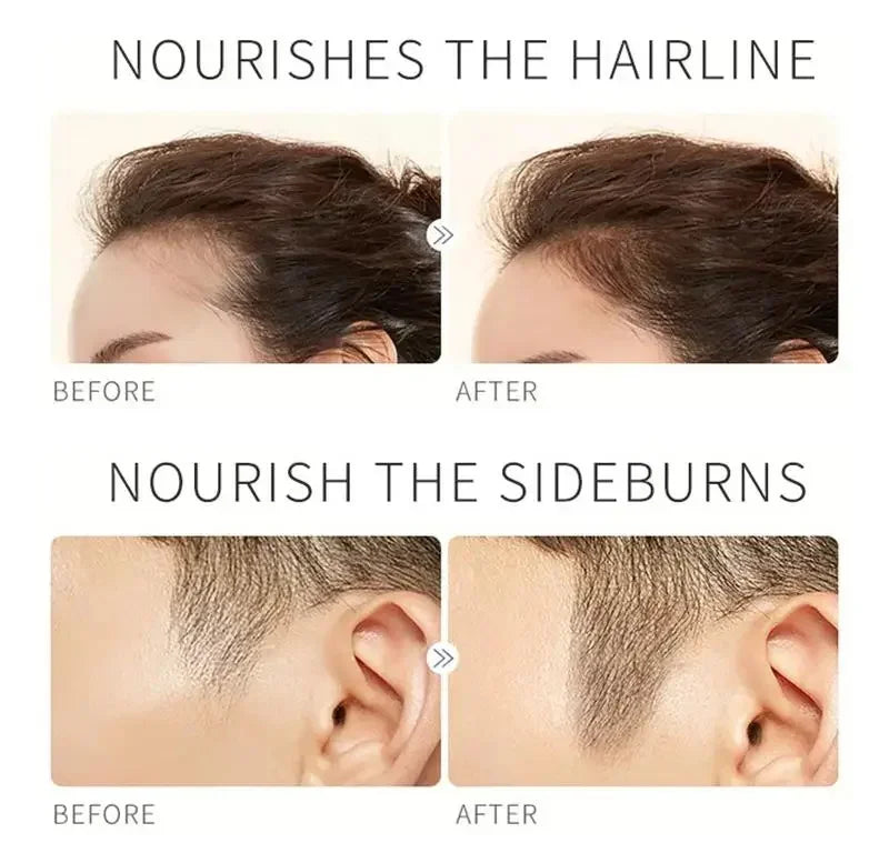 Fast Eyelash Growth Serum Eyebrow Hair Growth Anti Hairs Loss Product Prevent Baldness Fuller Thicker Lengthening Eyebrow Makeup.