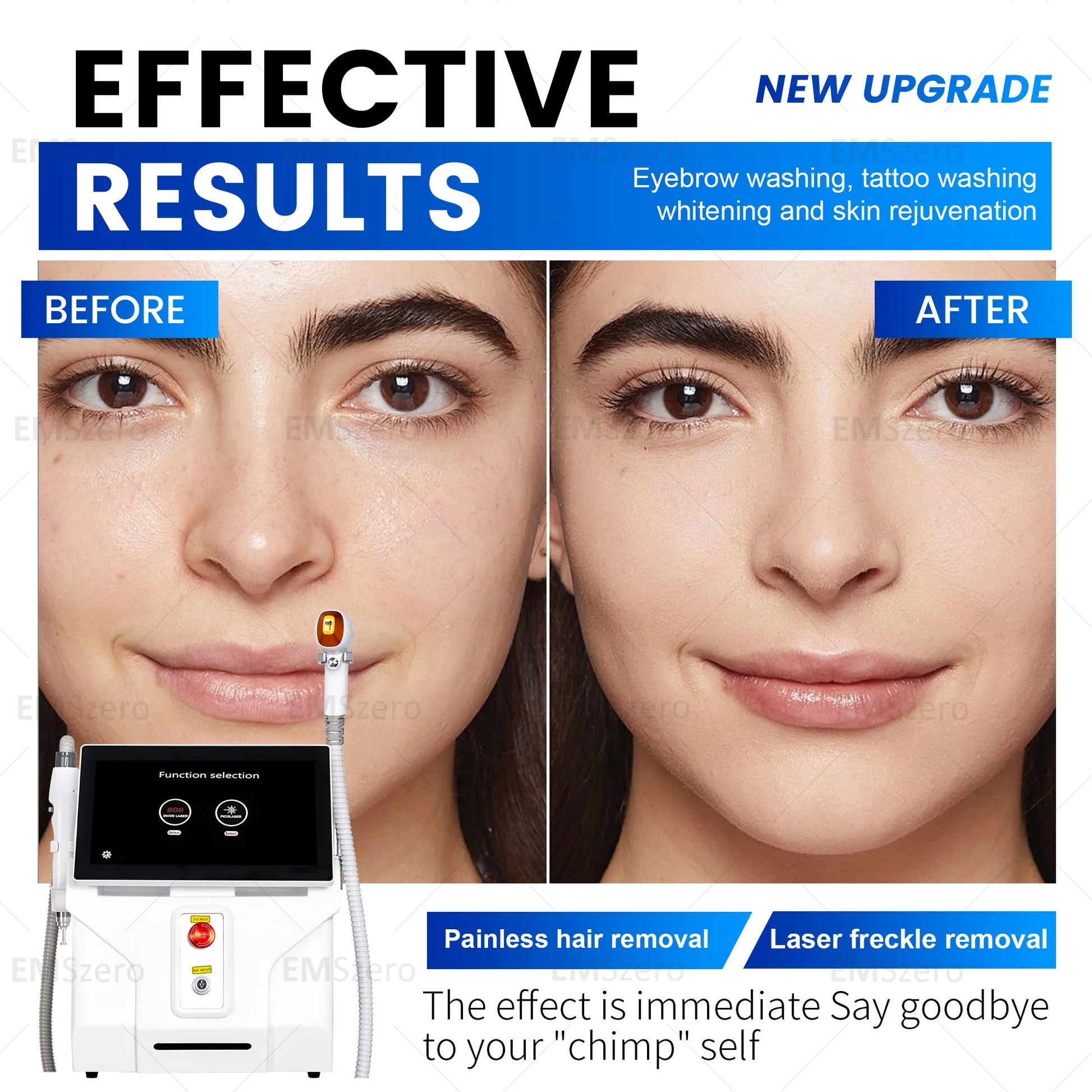 3000W Diode Laser Freezing Point Painless Hair Removal Picosecond Laser 532/1220/1064/755 Tattoo Removal Two In One Machine.