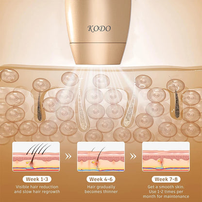 KODO 2025 High-end customization ice Laser Hair removal Laser Epilator Permanent IPL Painless Photoepilator 4 in 1 face and body.