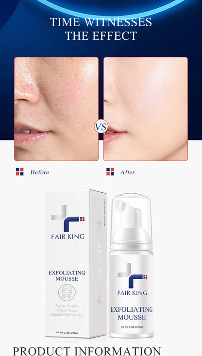 Facial Exfoliating Mousse Peeling Gel Face Scrub Deep Remove Cleaning All Skin Types Smooth Moisturizing Skin Exfoliator Cream.