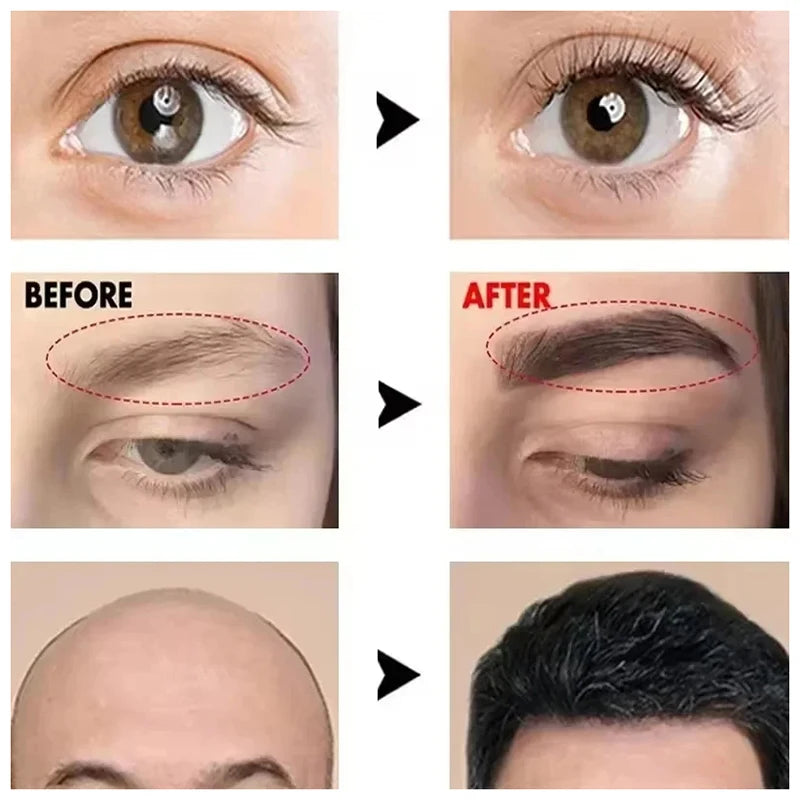 Fast Eyelash Growth Serum Eyebrow Hair Growth Anti Hairs Loss Product Prevent Baldness Fuller Thicker Lengthening Eyebrow Makeup.