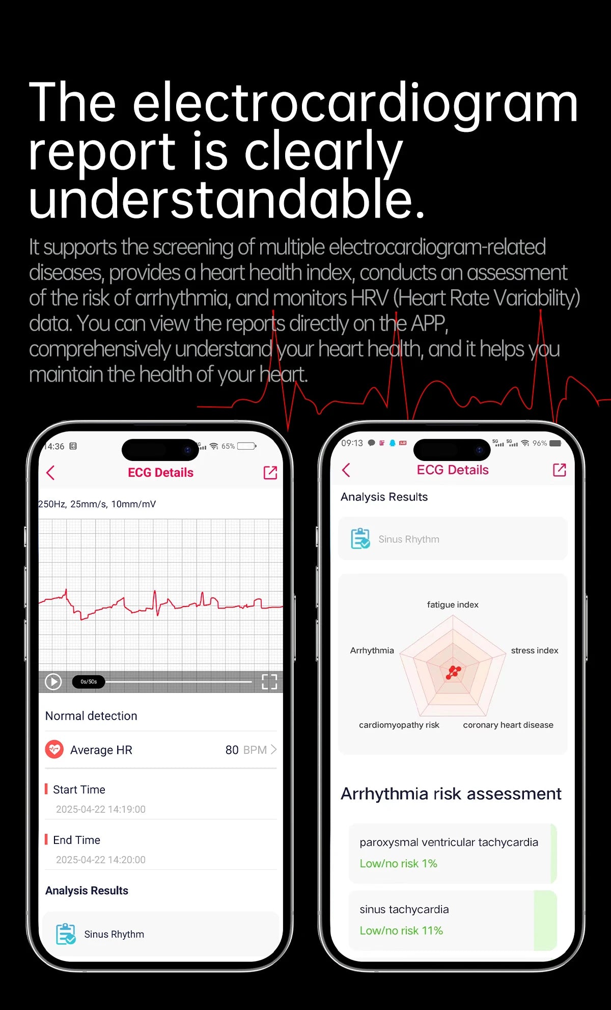 2025 New For XIAOMI Uric acid Blood lipids Smart Watch Men ECG+PPG Blood pressure Blood oxygen Bluetooth Call Health Smartwatchs.