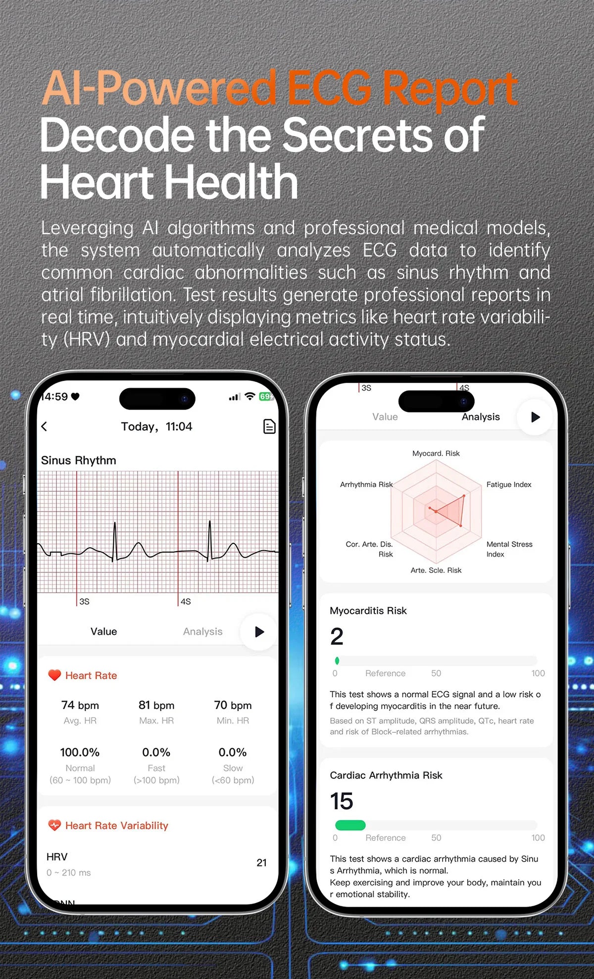 2025 New For HUAWEI Health MonitorUric Acid Blood Pressure Blood oxygen Body Analysis Smart Watch ECG+PPG Clock Smartwatch Men.