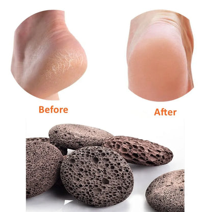 Pumice Stone , Scrubber Stone Pedicure Tools Natural Foot Scrubber for Exfoliation to Clear Callus on Hands Heels and Body.
