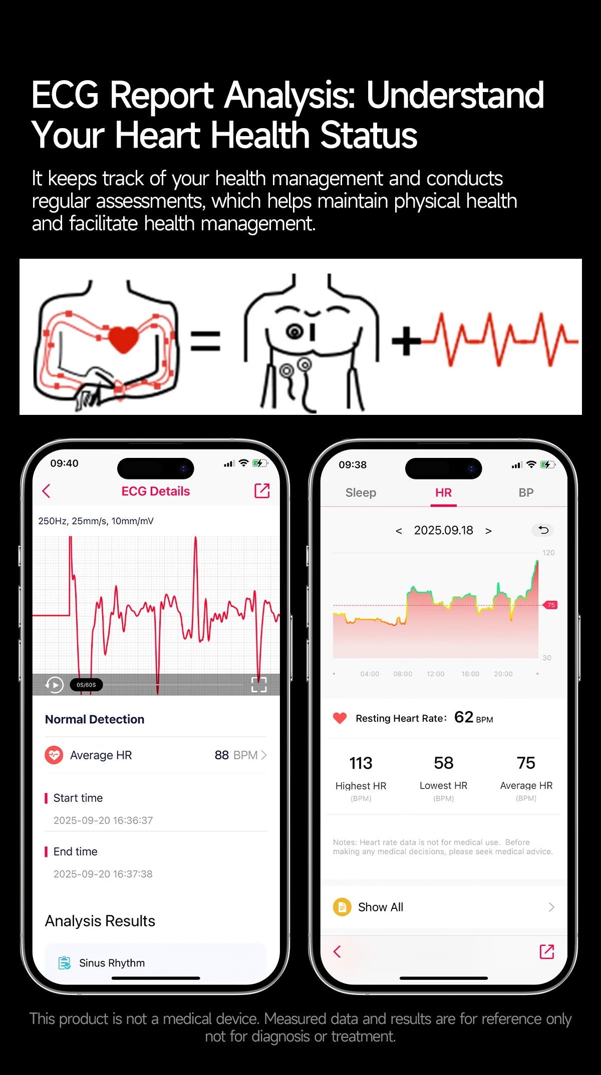 2026 New Smart Watch Men ECG+PPG Blood Lipids Uric Acid Blood Pressure Bluetooth Call 1.43'' Sapphire Smartwatch Remote Nursing.