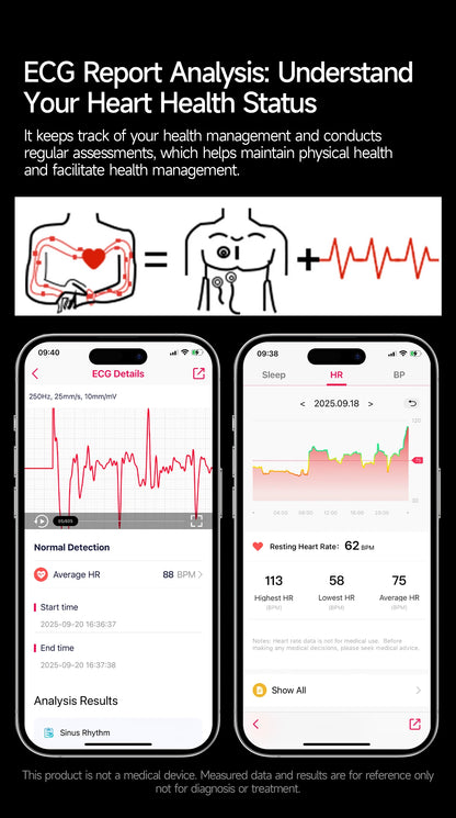 2026 New Smart Watch Men ECG+PPG Blood Lipids Uric Acid Blood Pressure Bluetooth Call 1.43'' Sapphire Smartwatch Remote Nursing.