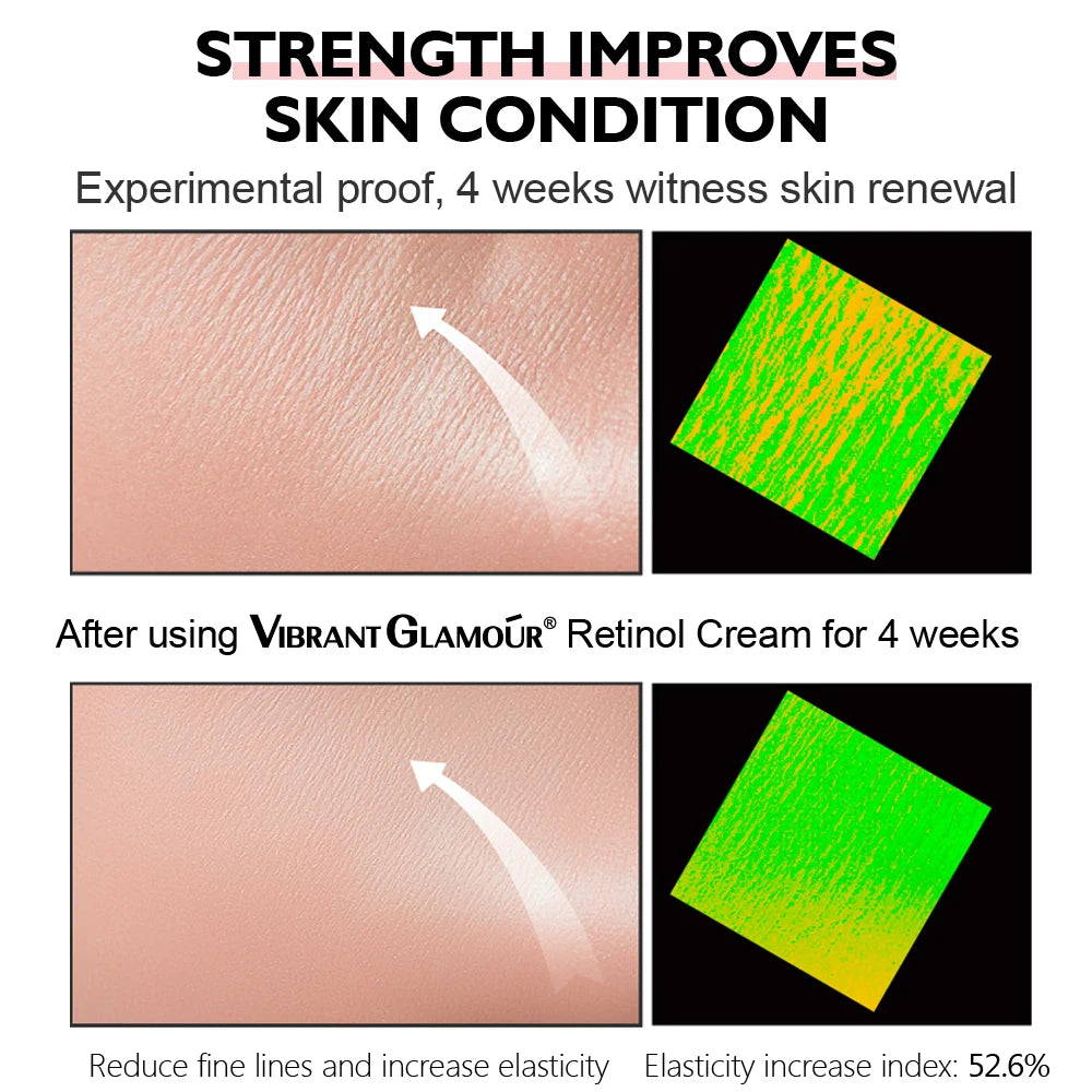 1/2/3/5PCS Retinol Facial Cream Anti-aging Removal Wrinkle Fine Lines Repair Skin Barrier Whitening Brightening Moisturizing.