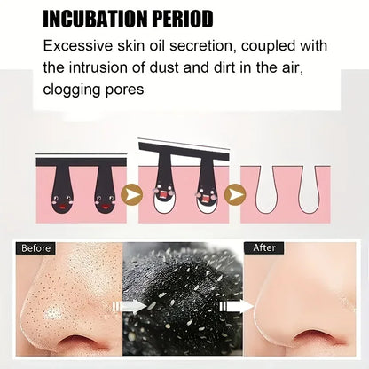 15pcs Blackhead Nose Strips Deep Cleansing Nasal Spot Facial Dot Stickers Nose Mask Shill For Acne & Black Head - Dropship.